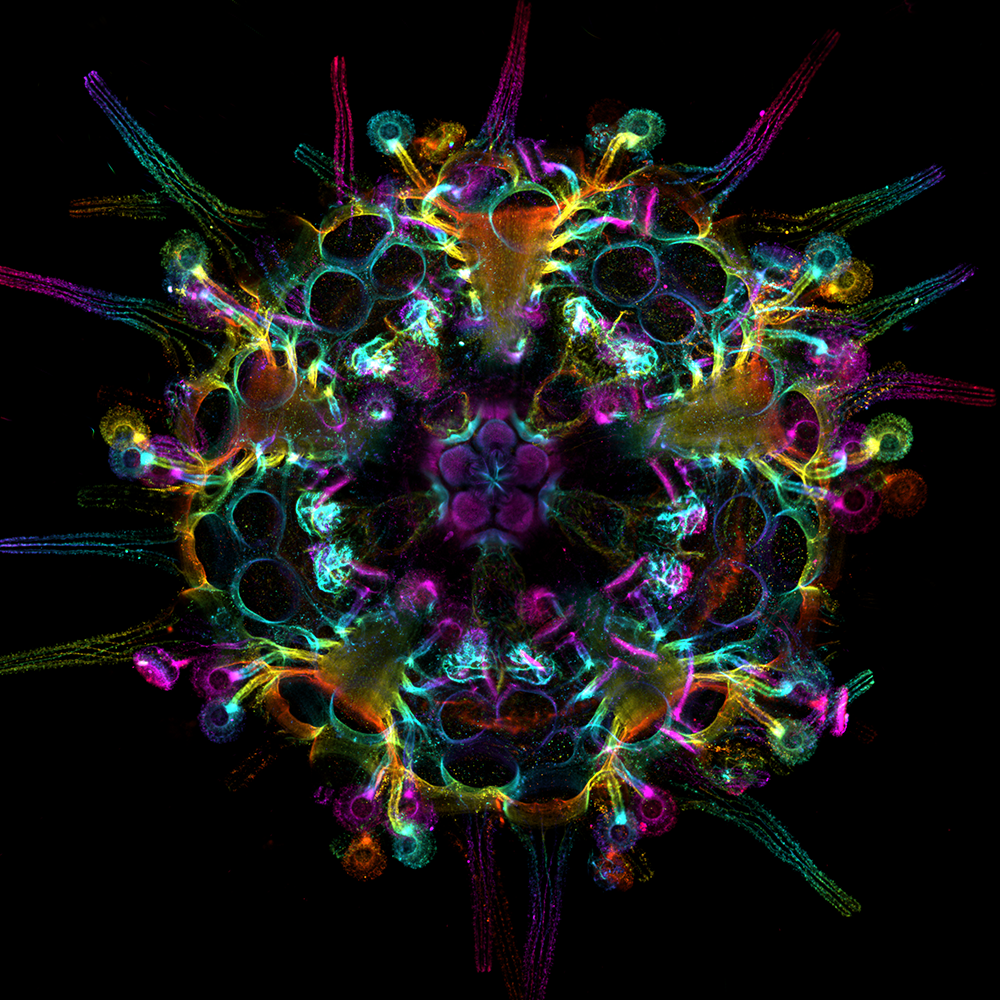cleared and stained sea urchin